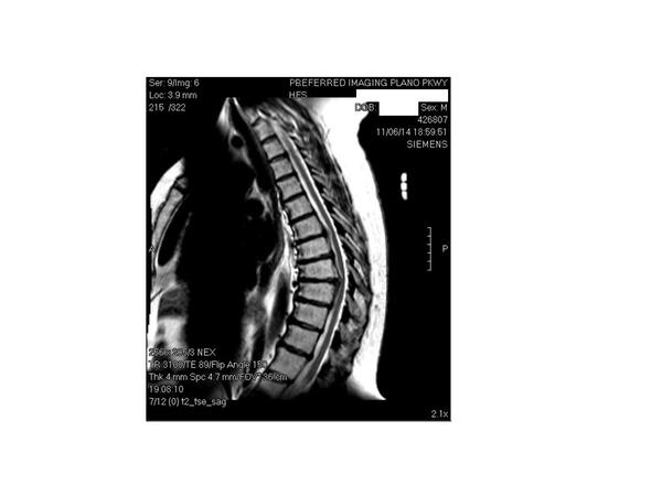 Brain & Spinal Cord Injuries